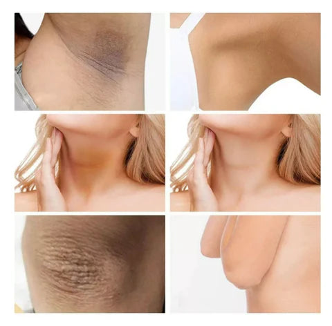 ✨ Crema Aclaradora para Axilas, Rostro, Rodillas, Manos y Cuello: ¡Revela Tu Piel Radiante con la fórmula COLÁGENO + LECHE! ✨